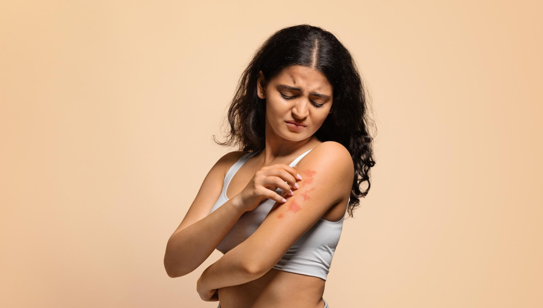 Managing Eczema & Sensitive Skin Flare-Ups During Seasonal Change