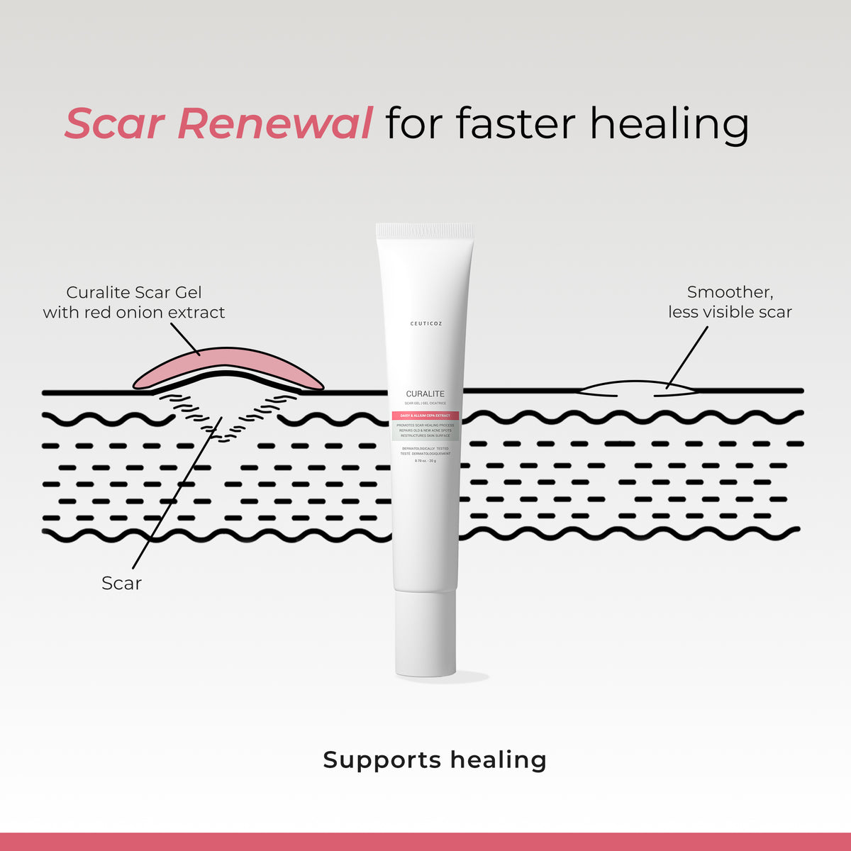 Curalite Scar Gel | Acne Scar & Mark Appearance Reduction