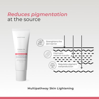 Curalite Lightening Cream | Dark Spot & Pigmentation Correction
